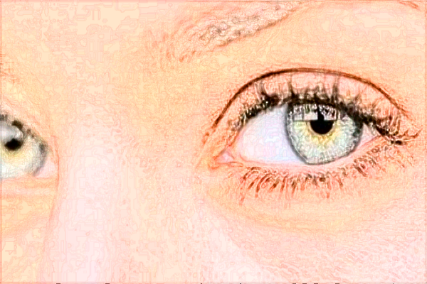 2024无锡市第二人民医院激光矫正靠谱吗_哪位医生技术比较好