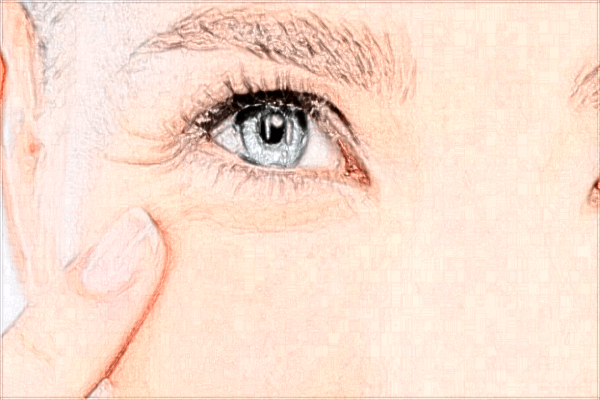 2024赣州市人民医院近视激光手术价格怎么样