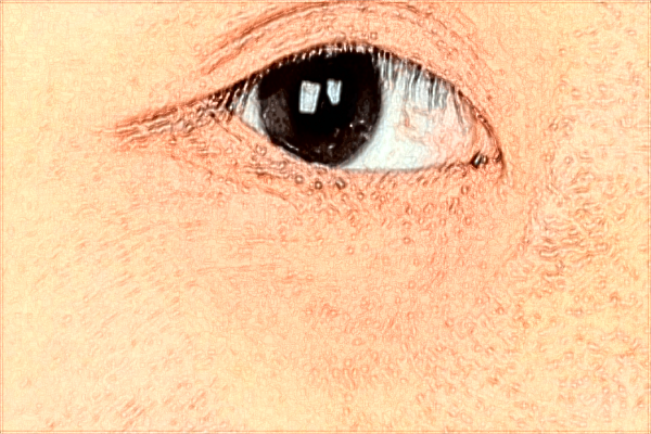 2024赣州市人民医院祛斑多少钱?激光祛斑怎么样