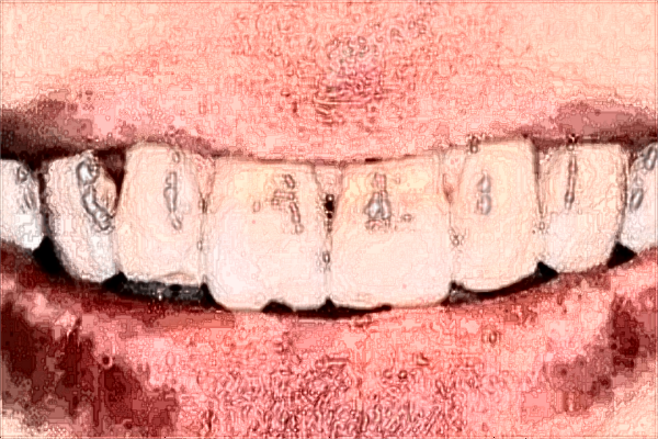 赣州市人民医院牙科医生名单?2024牙科收费价目表