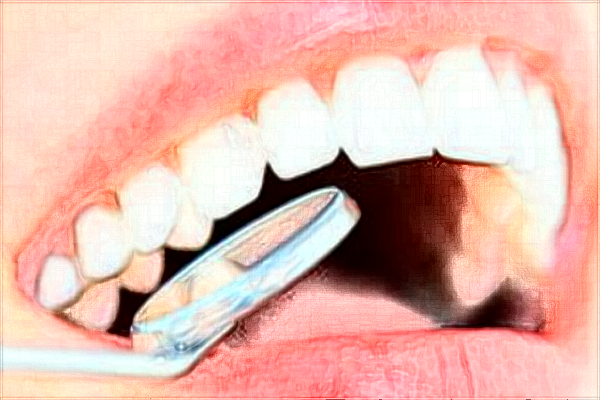 山东大学口腔医院牙齿正畸怎样?2022牙齿正畸费用多少