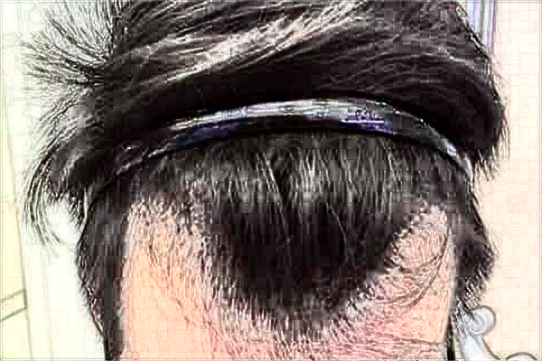 2024常州市第一人民医院植发价目表(价格表)怎么样