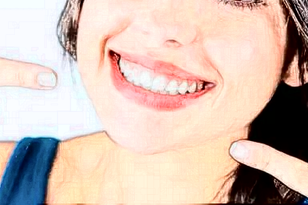 2024重庆医科大学附属口腔医院补牙哪个医生好_做的怎么样