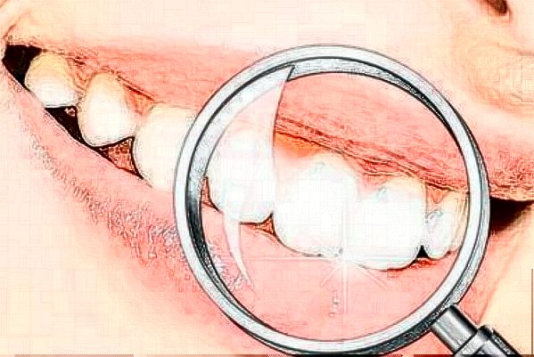 2024重庆医科大学附属口腔医院镶牙需要多少钱_案例分享