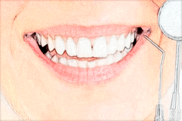 昆明总医院口腔科怎么样?口腔科收费价格2024