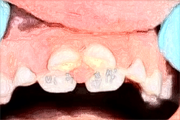 昆明总医院牙科怎么样?2024牙科项目收费价格