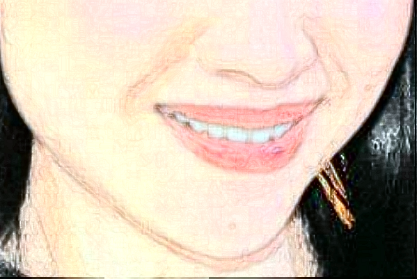 2024哈尔滨医科大学附属第一医院种植牙做的怎么样_哪位医生比较好