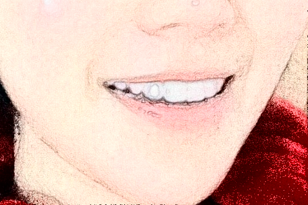 2024哈尔滨医科大学附属第一医院种植牙做的怎么样_哪位医生比较好