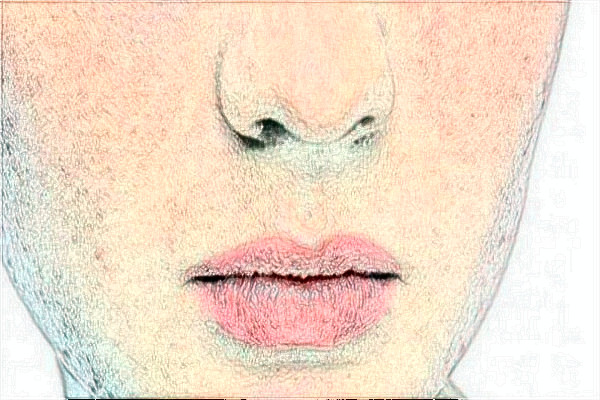 金华市中心医院激光祛胎记做的好吗_案例+价格