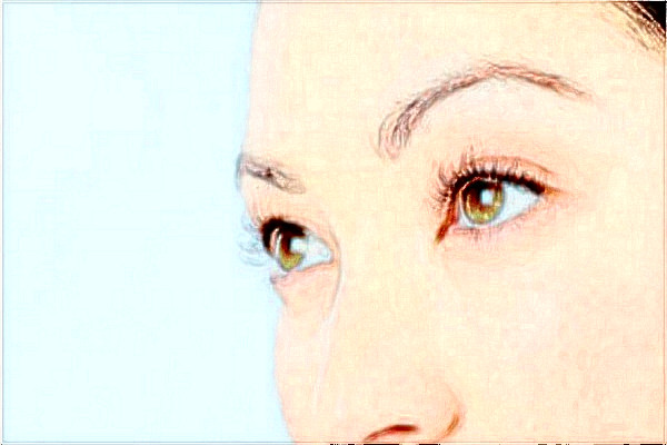 2024金华市中心医院激光祛斑做的咋样_案例分享