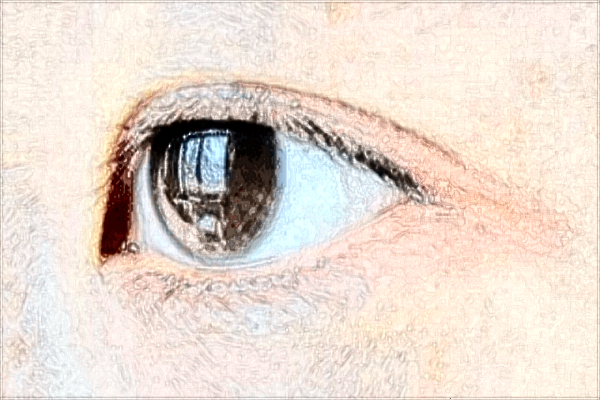 南昌大学第一附属医院近视眼手术好吗?2024近视眼手术费用