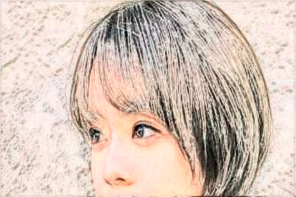 2024哈尔滨医科大学附属第一医院植发做的怎么样_哪位医生比较好