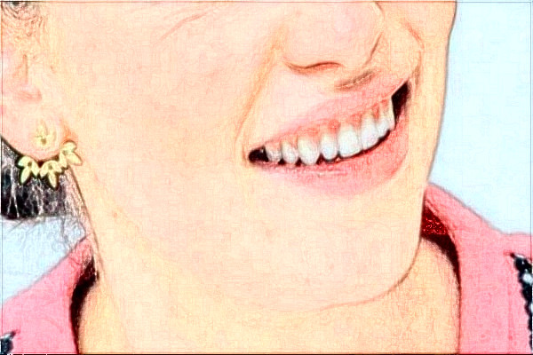 金华市中心医院整牙做的好吗_案例+价格