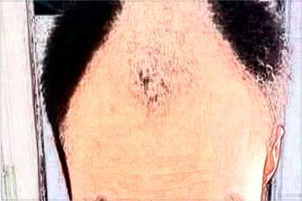 南宁303医院植发好吗?2024南宁303医院植发多少钱?