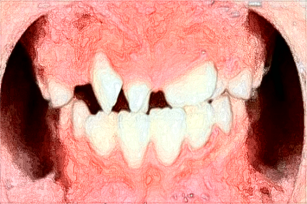 南宁市第—人民医院口腔科怎么样?2024口腔科收费如何