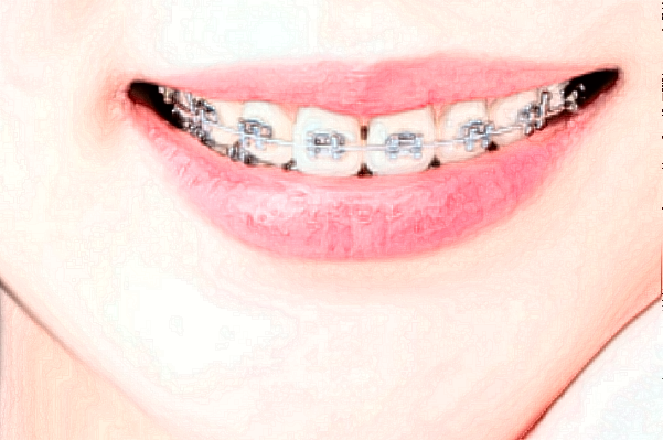 2024阜阳市人民医院牙齿矫正做的好吗_谁做的比较好