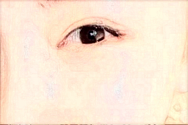 2024哈尔滨医科大学附属第一医院半飞秒怎么样_需要多少钱