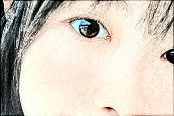 2024金华市中心医院全飞秒做的咋样_案例分享