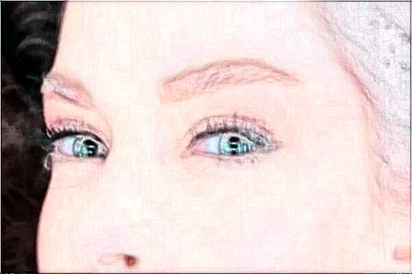 2024金华市中心医院全飞秒做的咋样_案例分享