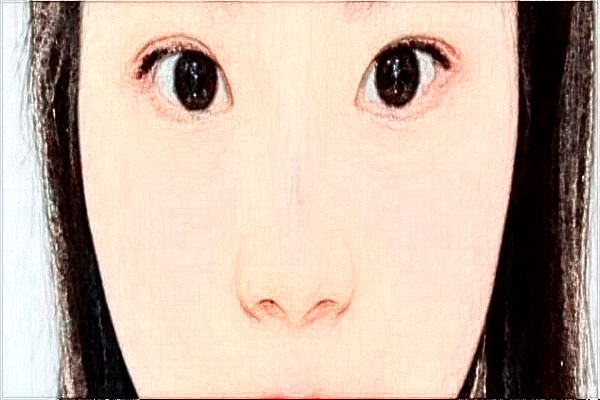 2024金华市中心医院全飞秒做的咋样_案例分享