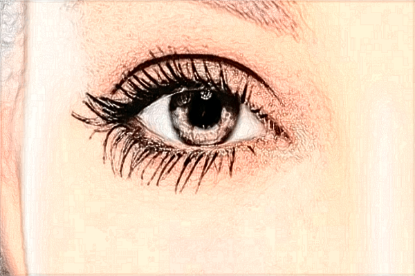 2024南宁303医院近视激光手术费?近视手术需要多久