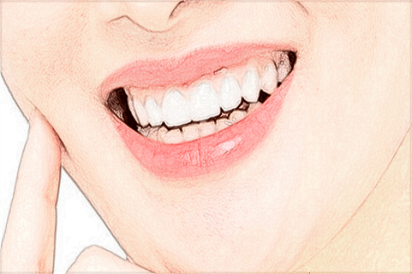 中山大学附属口腔医院种植牙看哪个医生好?医生的技术很重要吗