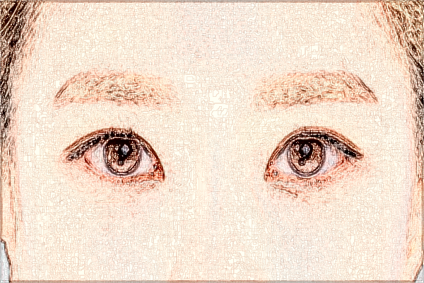 2024珠海市人民医院做双眼皮怎么样?双眼皮埋线需要多少钱