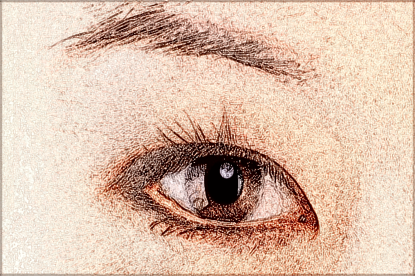 2024珠海市人民医院去眼袋手术大概价格?去眼袋多久恢复正常