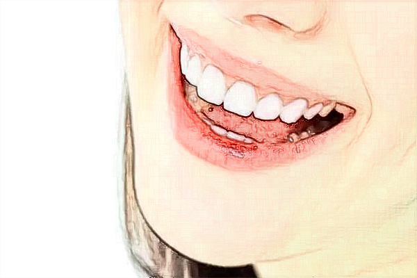 2024泉州180医院种牙多少钱?种牙的好处与危害