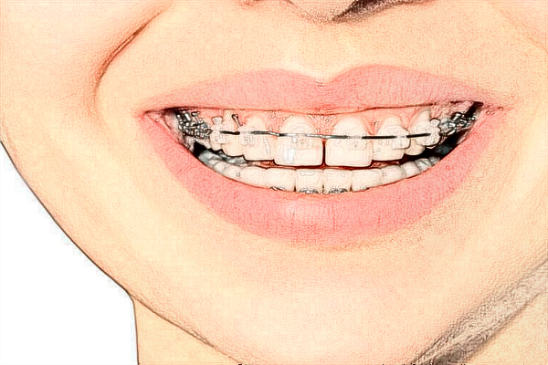 广东省中医院珠海医院口腔科怎么样?2024口腔科收费价格