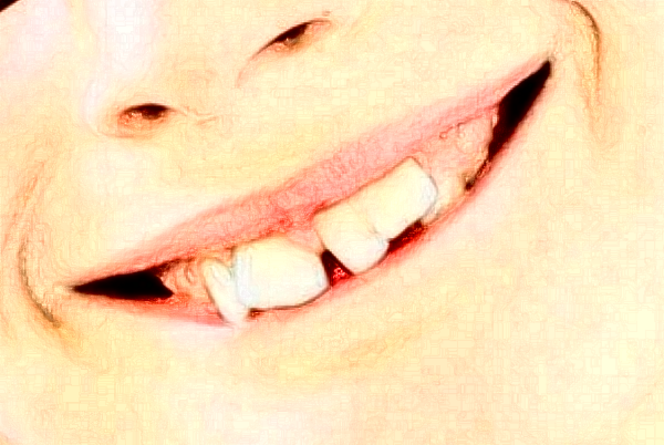 2024天津市口腔医院种植牙需要多少钱?谁做得好