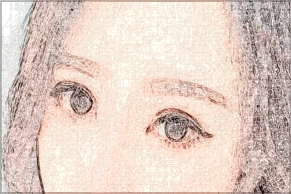 中山市人民医院去川字纹去哪科?2024去川字纹多少钱