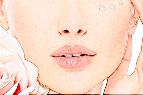 2024泉州180医院激光祛痘印价格?激光祛痘印一次能去掉吗?