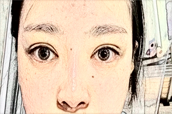 2024天津人民医院激光祛斑怎么样？案例价格一览