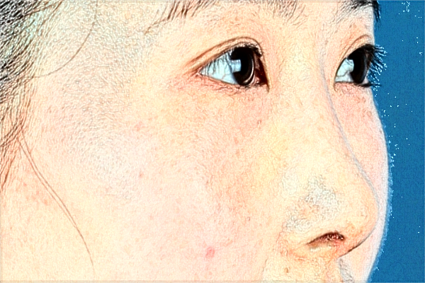 2024天津人民医院激光祛斑怎么样？案例价格一览