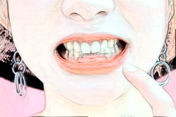 天津市口腔医院根管多少钱_做的好吗？