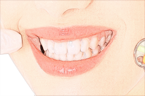 2024泉州180医院牙科拔智齿贵不?拔智齿多少钱