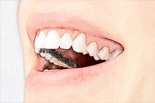 2024武汉大学口腔医院口腔科洗牙收费?口腔科洗牙挂什么科