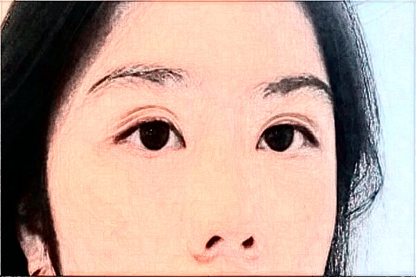 2024哈尔滨医科大学附属第二医院全飞秒多少费用？医生推荐