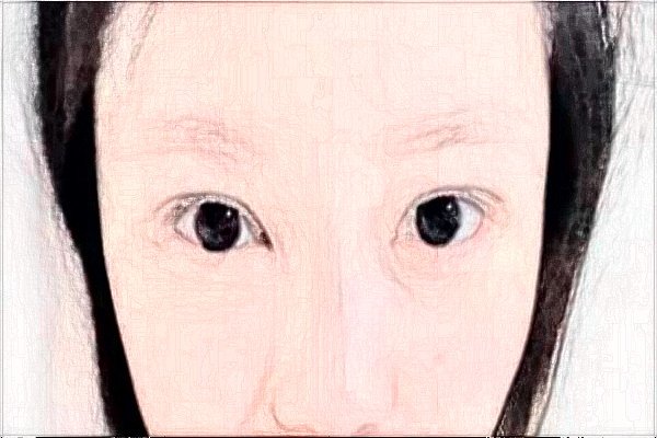 2024天津人民医院做的好吗_医生推荐