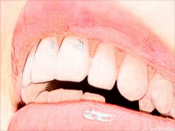 中山大学附属口腔医院口腔正畸科的范围?2024正畸科价格