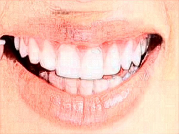 中山大学附属口腔医院口腔修复科治什么?可以补牙吗?