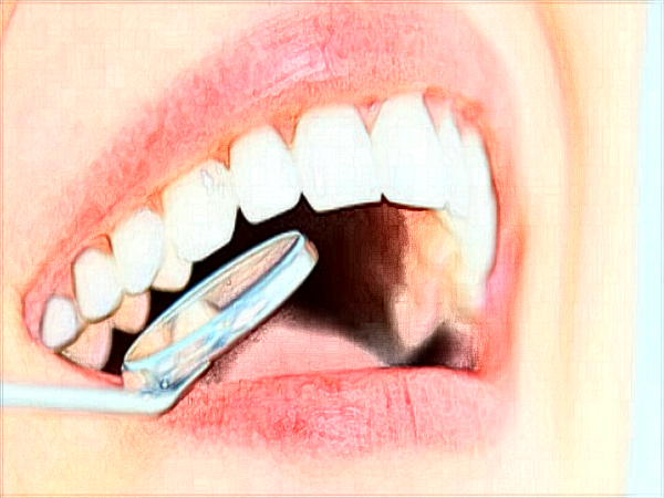 中山大学附属口腔医院口腔修复科治什么?可以补牙吗?