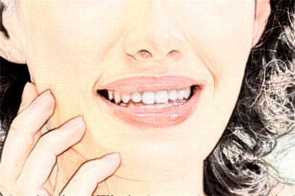 2024青岛市立医院去痣多少钱?去痣应该去哪个科