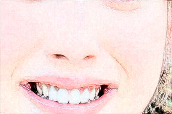 2024阜阳市人民医院激光脱毛价格多少？做的怎么样