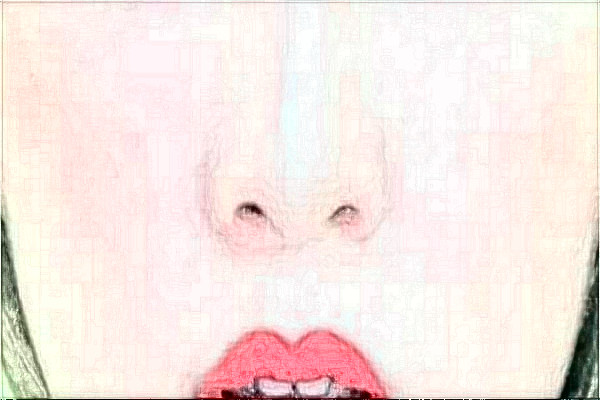 天津人民医院激光脱毛怎么样【激光脱毛案例分享】