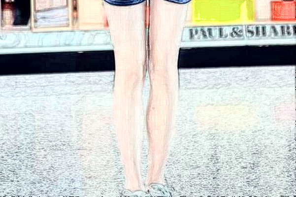 天津人民医院激光脱毛怎么样【激光脱毛案例分享】