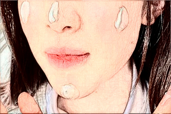 2024杭州市第一人民医院光子嫩肤怎么样_医生介绍