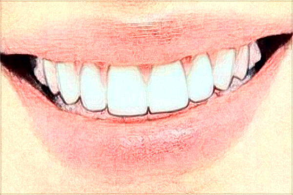 2024大连新华医院口腔科烤瓷冠做的怎么样_哪位医生做得好