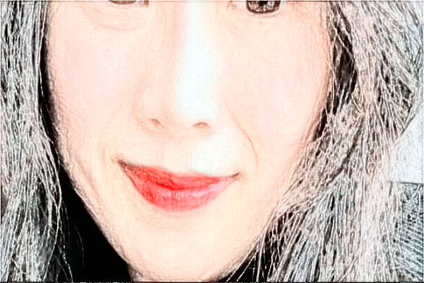 2024南京中大医院激光除皱做的怎么样【整形案例分享】